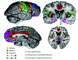 © 2007 Borsook et al; licensee BioMed Central Ltd